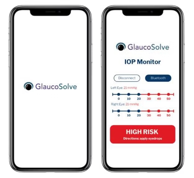 Mobile App